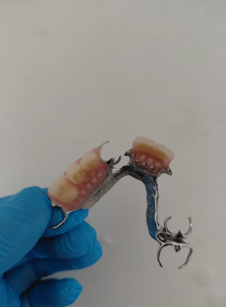 Reparación de prótesis dental