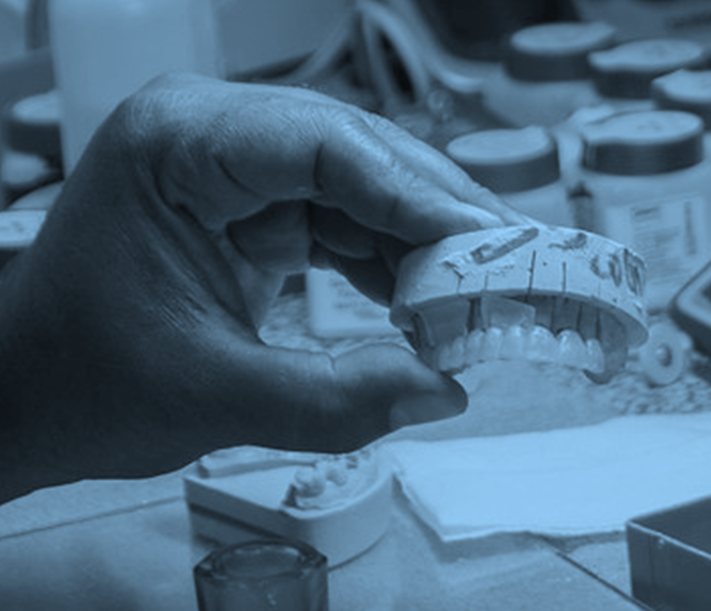 Trabajo de laboratorio dental